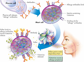 Allergic Rhinitis