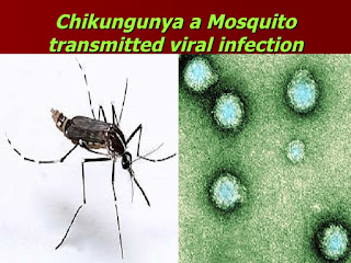 Chikungunya