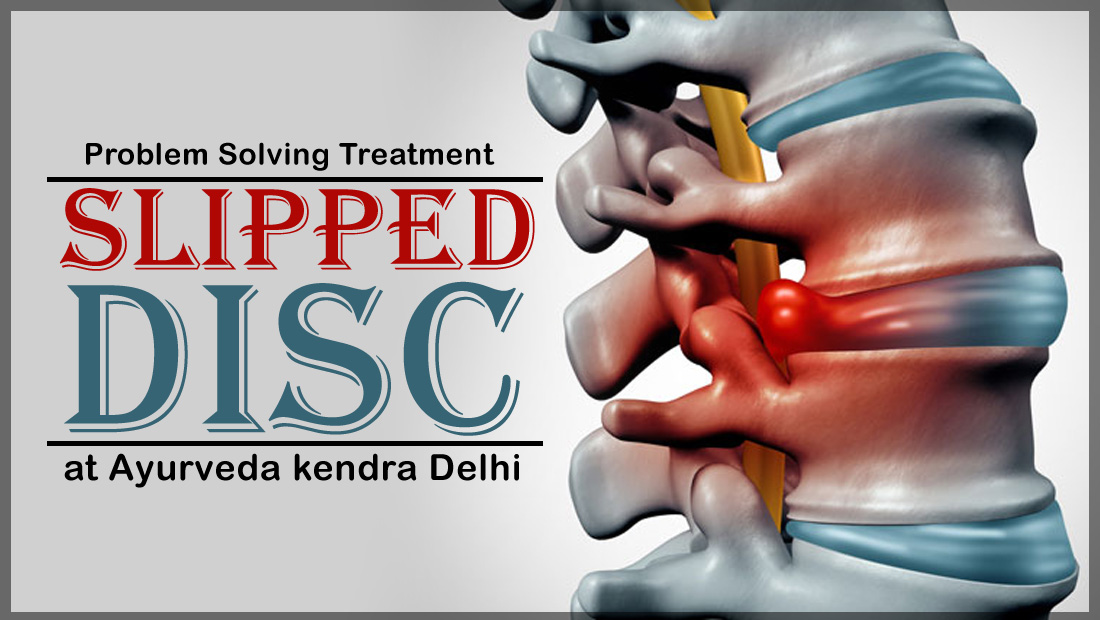 Slipped disc